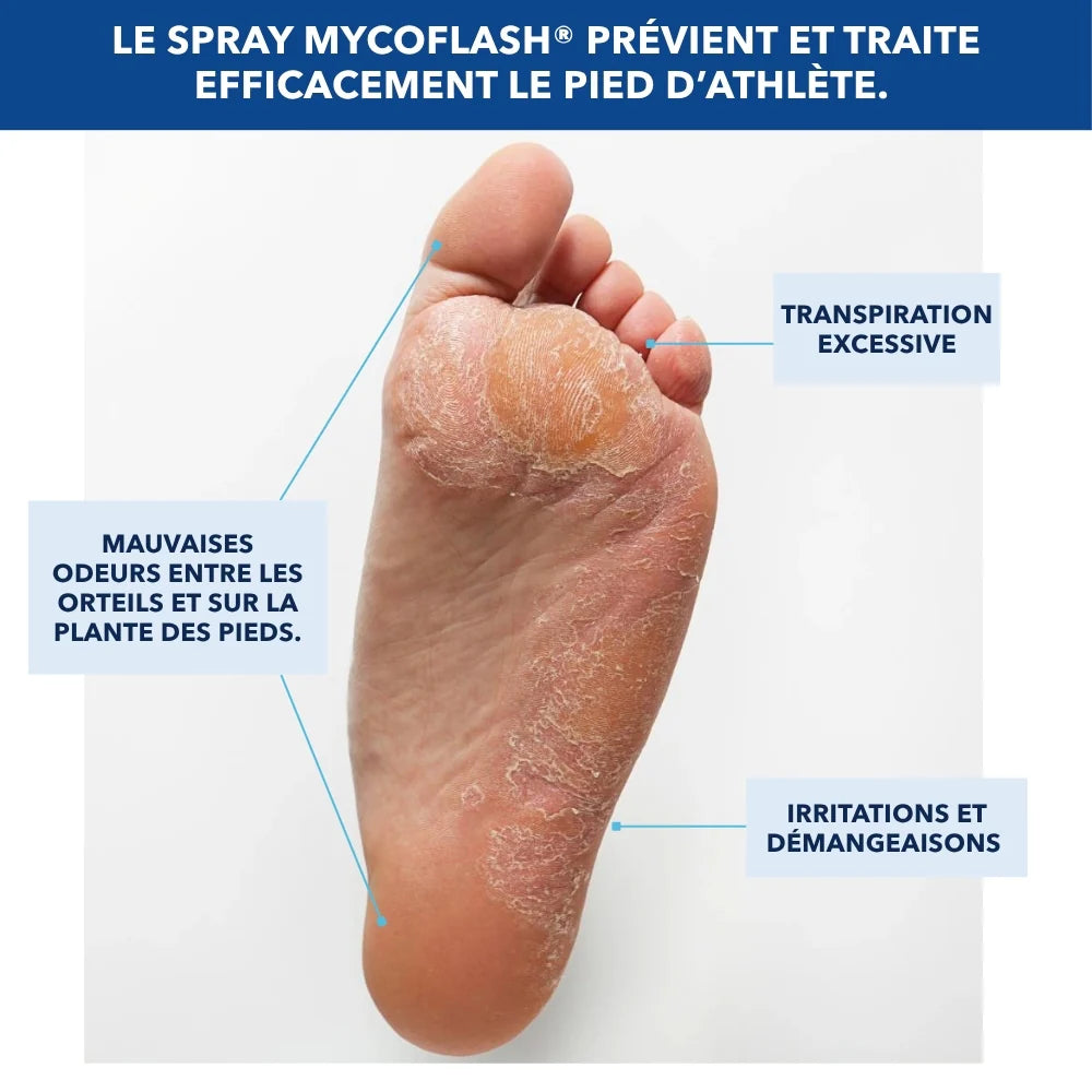 🦶💨 MYCOFLASH® – Spray SPRAY ANTIFONGIQUE POUR LE PIED D'ATHLÈTE (25 ml)