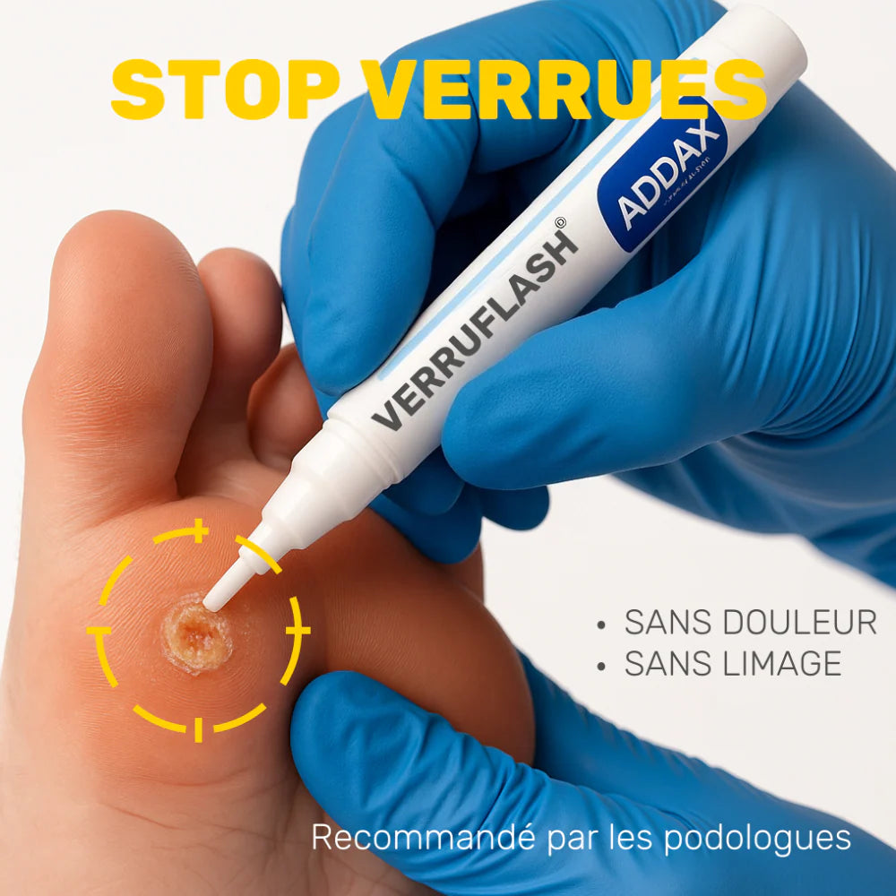 ✋🦶 VERRUFLASH® – Stylo de traitement des verrues mains, pieds et corps