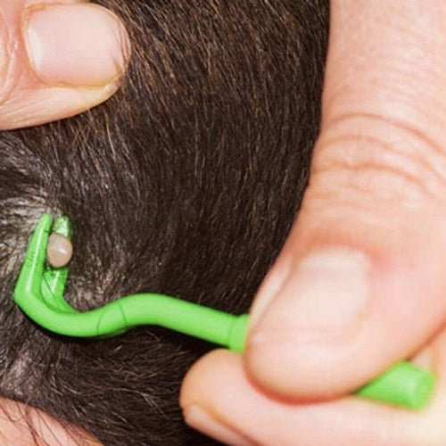 🦠 3 Crochet à Tiques Tick Twister d'O'Tom - Retrait rapide et sans douleur 🚫🐜 - CBF Medical
